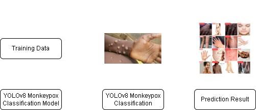Monkeypox detection pipeline (YOLOv8, 98.8%)